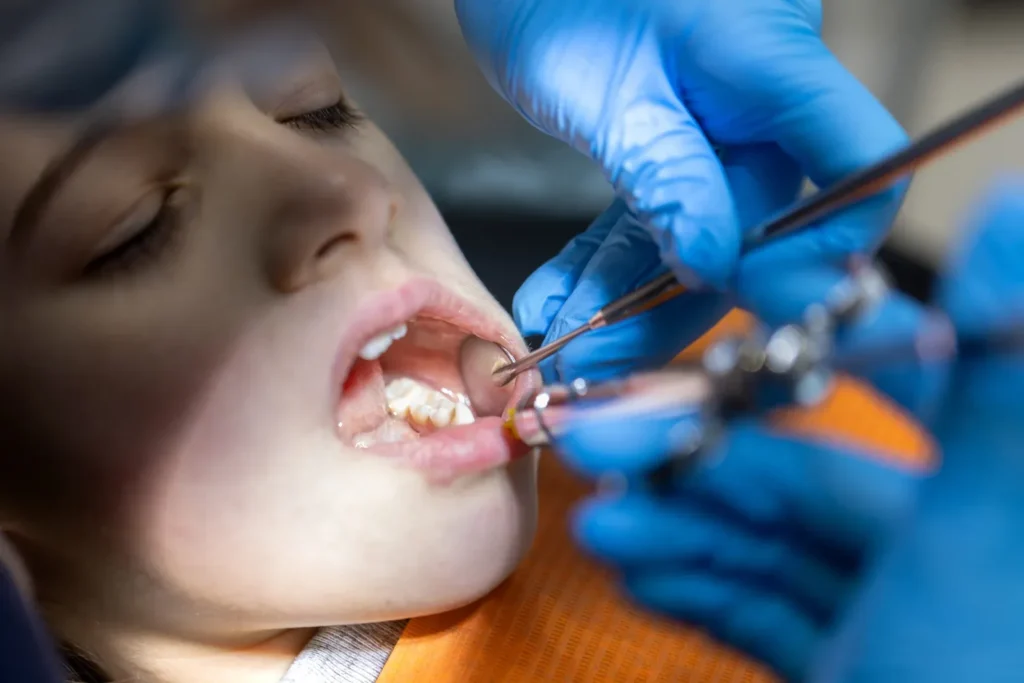 Dental Check-up & Consultation